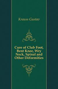 Cure of Club Foot, Bent Knee, Wry Neck, Spinal and Other Deformities