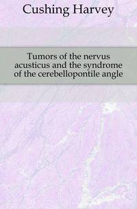 Tumors of the nervus acusticus and the syndrome of the cerebellopontile angle