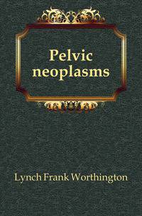 Pelvic neoplasms