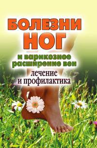 Болезни ног и варикозное расширение вен. Лечение и профилактика