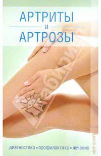 Артриты и артрозы. Диагностика, профилактика, лечение