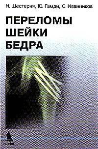 Переломы шейки бедра: Современные методы лечения: Для травматологов, ортопедов хирургов