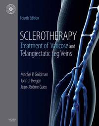 Sclerotherapy,