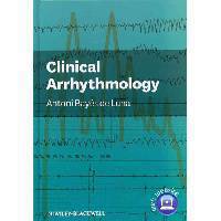 Clinical Arrhythmology