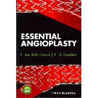 Essential Angioplasty