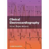 Clinical Electrocardiography: A Textbook