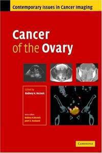 Cancer of the Ovary