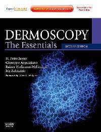 Dermoscopy: The Essentials: Expert Consult - Online and Print