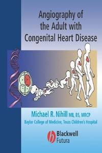 Angiography of the Adult with Congenital Heart Disease.2005