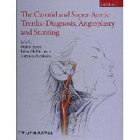 The Carotid and Supra-Aortic Trunks