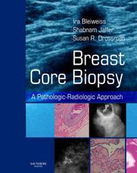 Breast Core Biopsy,