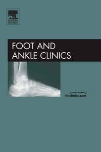 Advances in Posterior Tibial Tendon Insufficiency, An Issue of Foot and Ankle Clinics
