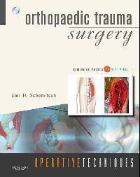 Orthopaedic Trauma Surgery