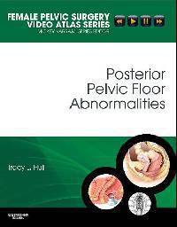 Posterior Pelvic Floor Abnormalities