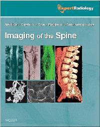 Imaging of the Spine