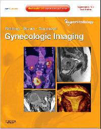 Gynecologic Imaging