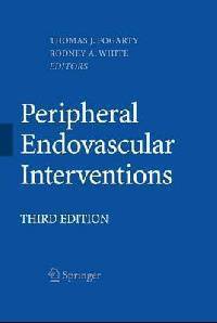 Peripheral Endovascular Interventions