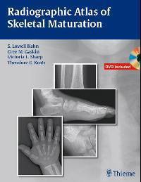 Radiographic Atlas of Skeletal Maturation