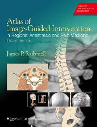 Atlas of Image-Guided Intervention in Pain Medicine