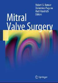 Mitral Valve Surgery