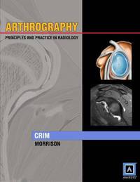 Arthrography: Principles & Practice in Radiology Published by AmirsysR