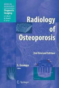 Radiology of Osteoporosis / Рентгенология остеопороза