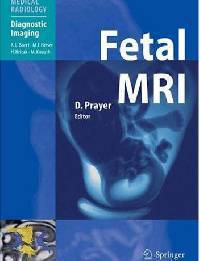 Fetal MRI