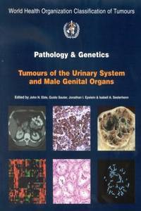 Pathology & Genetics of Tumours of the Urinary System & Male Genital Organs. 2004