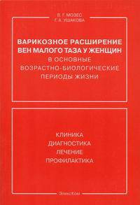 Варикозное расширение вен малого таза у женщин в основные возрастно-биологические периоды жизни. Клиника, диагностика, лечение, профилактика