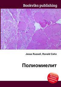 Полиомиелит