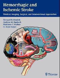 Hemorrhagic and Ischemic Stroke: Medical, Imaging, Surgical and Interventional Approaches