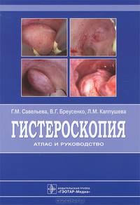 Гистероскопия. Атлас и руководство