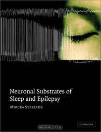 Neuronal Substrates of Sleep and Epilepsy
