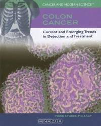Colon Cancer: Current And Emerging Trends In Detection And Treatment (Cancer and Modern Science)