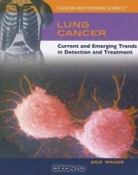 Lung Cancer: Current And Emerging Trends in Detection And Treatment (Cancer and Modern Science)