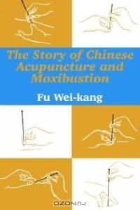 The Story of Chinese Acupuncture and Moxibustion