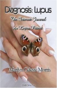 Diagnosis: Lupus: The Intimate Journal of a Lupus Patient