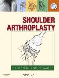Shoulder Arthroplasty
