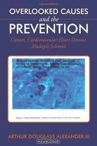 Overlooked Causes and the Prevention: Cancer, Cardiovascular Heart Disease, Multiple Sclerosis