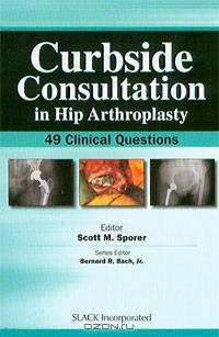 Curbside Consultation in Hip Arthroplasty: 49 Clinical Questions