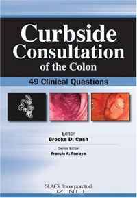 Curbside Consultation of the Colon: 49 Clinical Questions (Curbside Consultation in Gastroenterology)