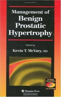 Management of Benign Prostatic Hypertrophy (Current Clinical Urology Ser)