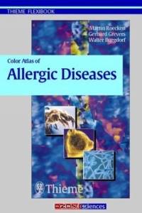Color Atlas of Allergic Diseases (Thieme Flexibook)
