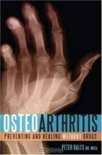 Osteoarthritis: Preventing and Healing Without Drugs