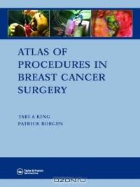 Atlas of Procedures in Breast Cancer Surgery