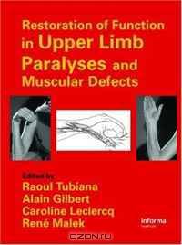 Restoration of Functions in Upper Limb Paralyses and Muscular Defects