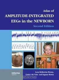 An Atlas of Amplitude-Integrated EEGs in the Newborn, Second Edition, with DVD