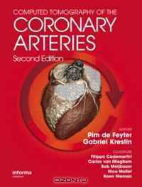 Computed Tomography of the Coronary Arteries