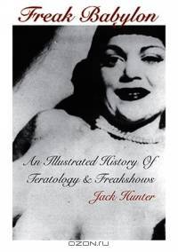 Freak Babylon: An Illustrated History of Teratology & Freakshows