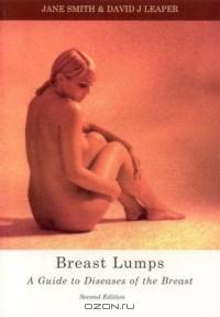Breast Lumps : A Guide to Diseases of the Breast